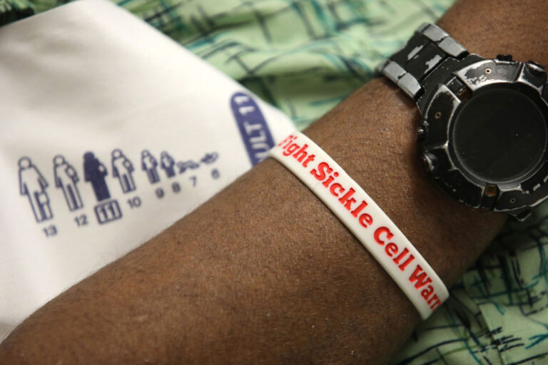 Sickle Cell Gene Therapy , Prairie View A&M University