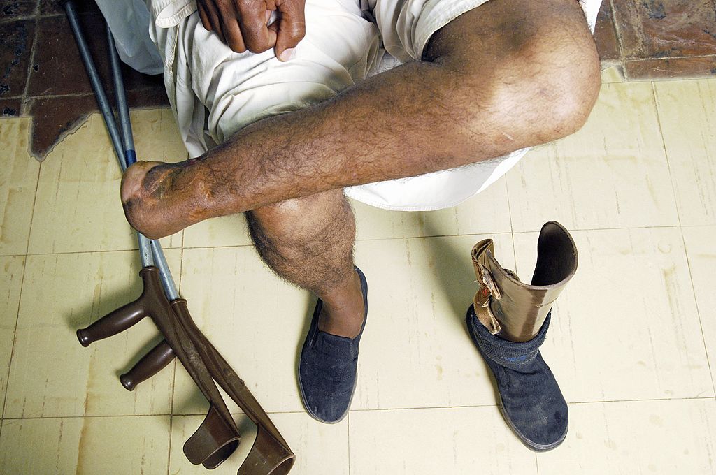 Anthony Morgan, diabetic, amputee, John Bridges,