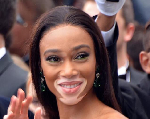 Winnie Harlow