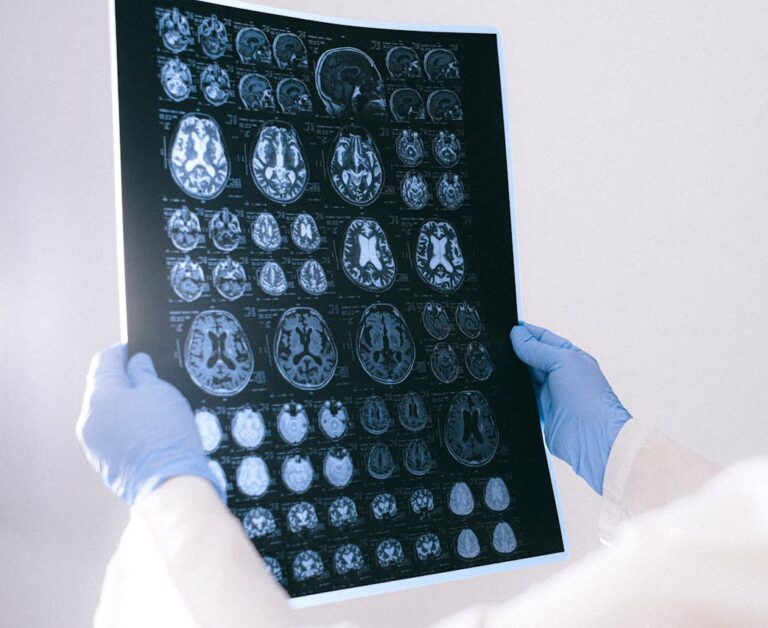 jason collins, brain tumor